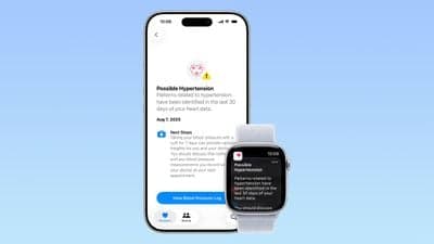 Upgrading to Apple Watch Series 12 Could Cost You Hypertension Notifications - MacRumors image 2